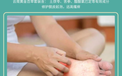 脚痒脱皮起水疱烂脚丫用什么药最好,专业用药指南助你恢复
