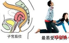 子宫后位如何怀孕,科学备孕，助您顺利好“孕”